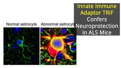 Deficiency of Innate Immune Adaptor TRIF Linked to Neurodegeneration
