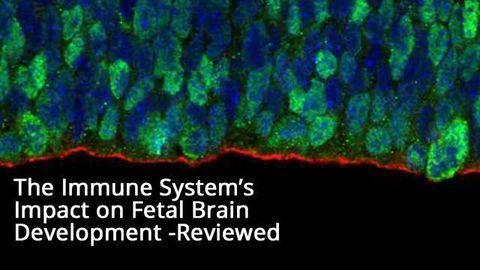The Immune System's Influence on Brain Development Reviewed