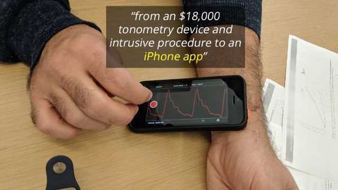 Detecting Heart Disease with an AI App