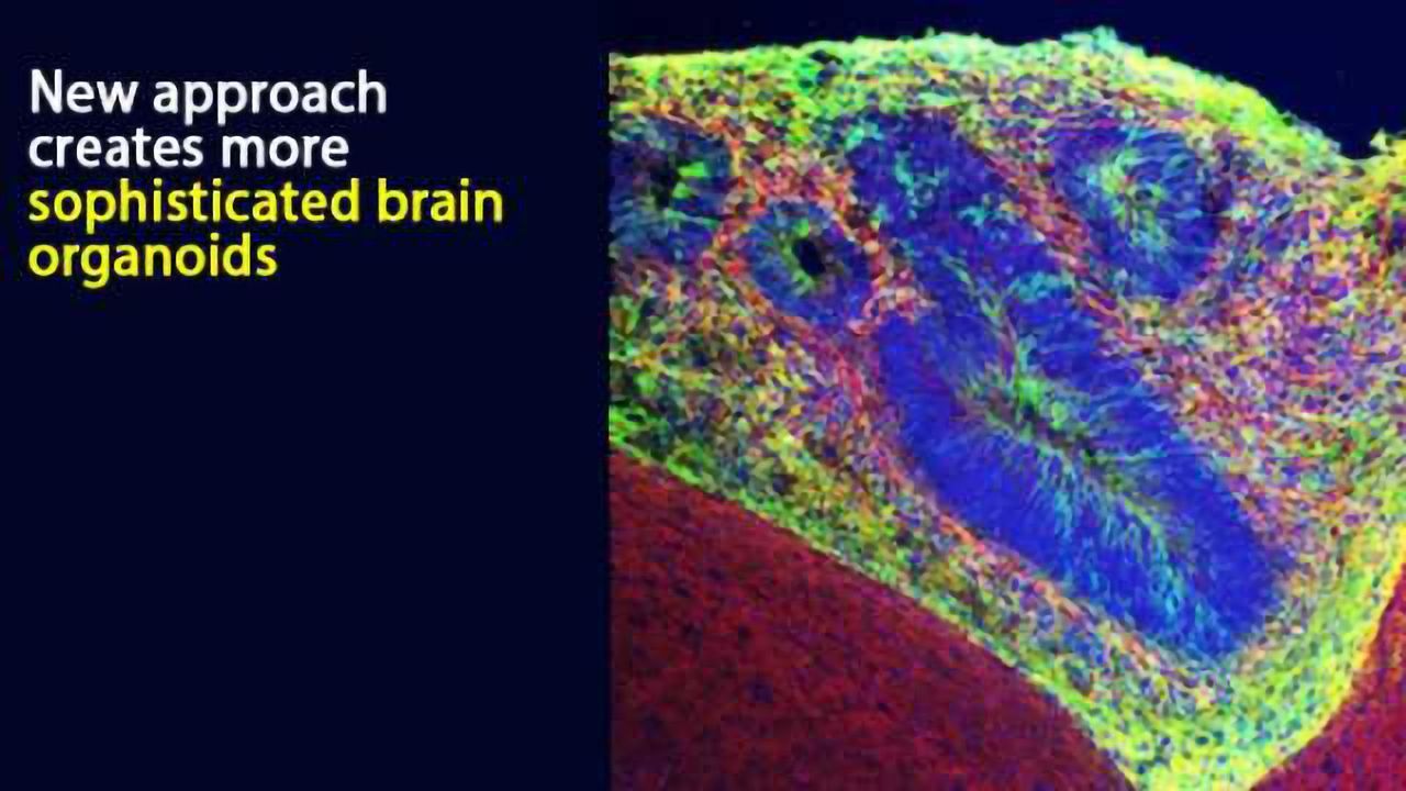 Grafted Brain Organoids Provide Insight into Neurological Disorders