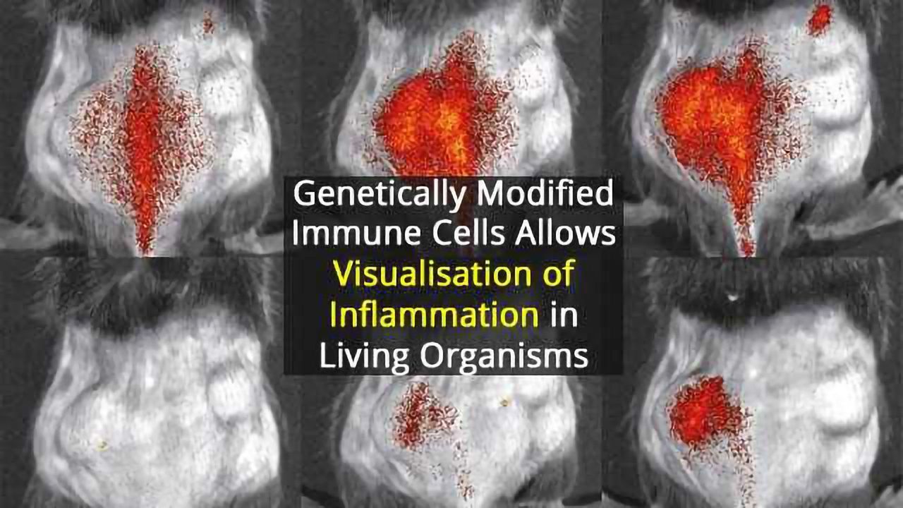 Understanding Inflammation From the Inside Out