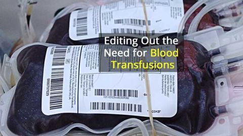 Gene Therapy Could End Transfusions for Blood Disorder Patients