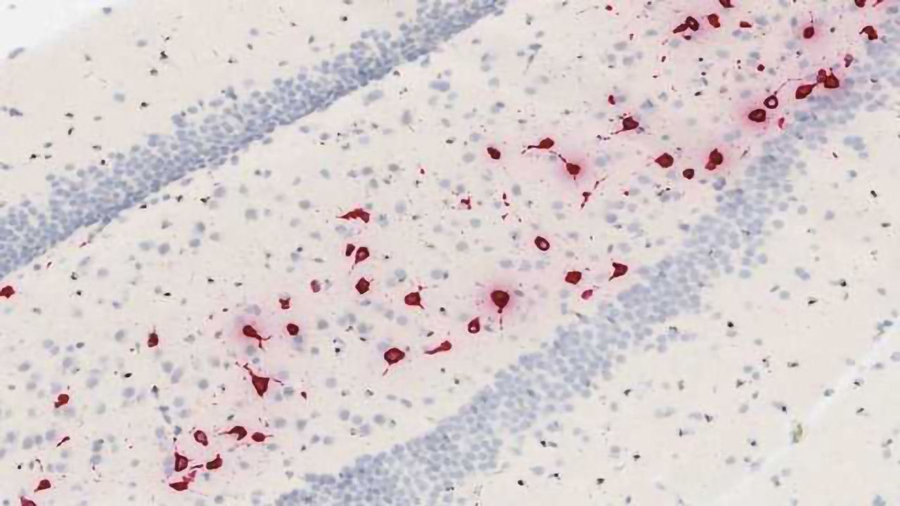 Bio-Techne Expands RNAscope® ISH Automation - Facilitating Drug Discovery and Development