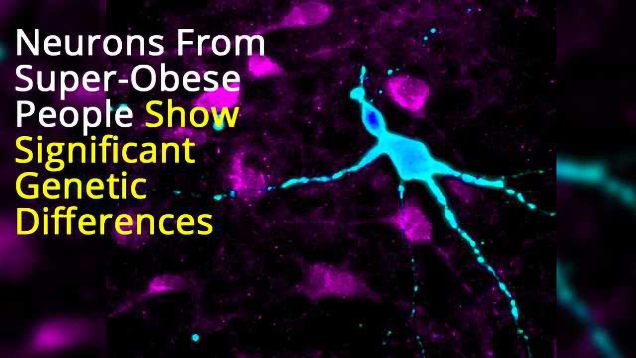 Super-Obese People's Hypothalamic Neurons Show Several Genetic Differences to Non-Obese Neurons