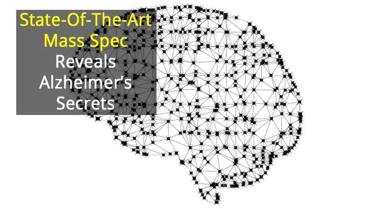 Stable Beta-Amyloid Dimers Identified in Alzheimer’s Brains