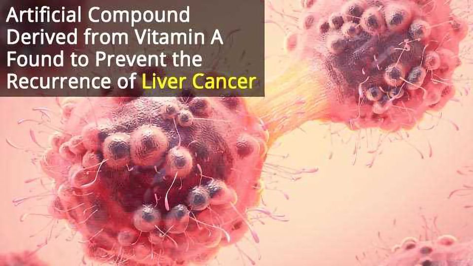 Compound Selectively Kills Liver Cancer Stem Cells Technology Networks