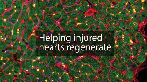 New Cell Therapy Aids Heart Recovery—Without Implanting Cells