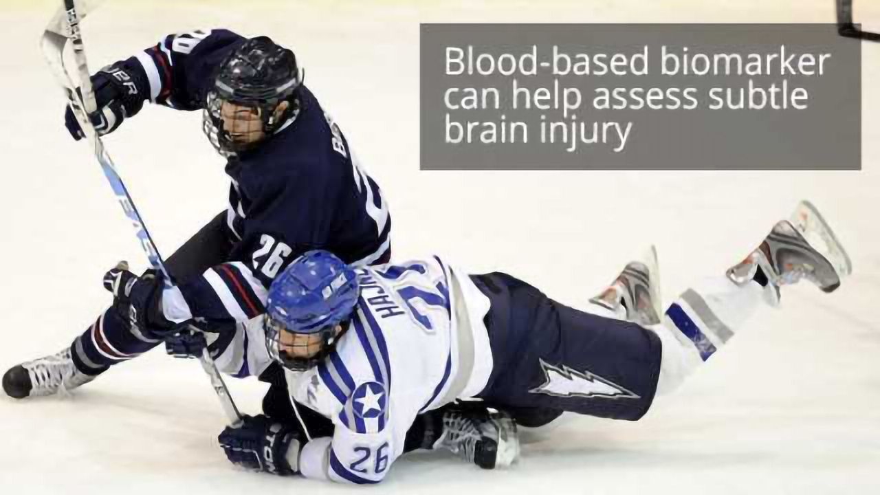 Blood Test To Determine When It Is Safe To Return To Play After A Sports-related Concussion