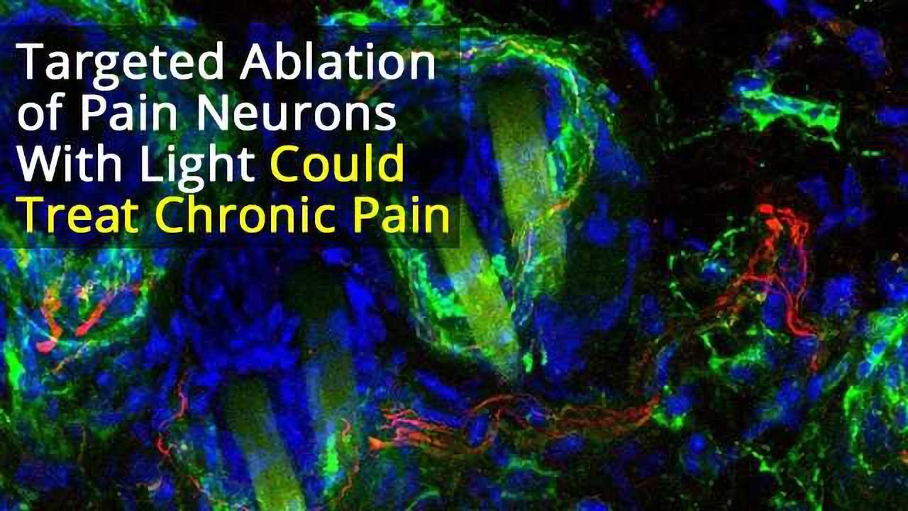 Photoablation of Sensory Neurons to Manage Chronic Pain