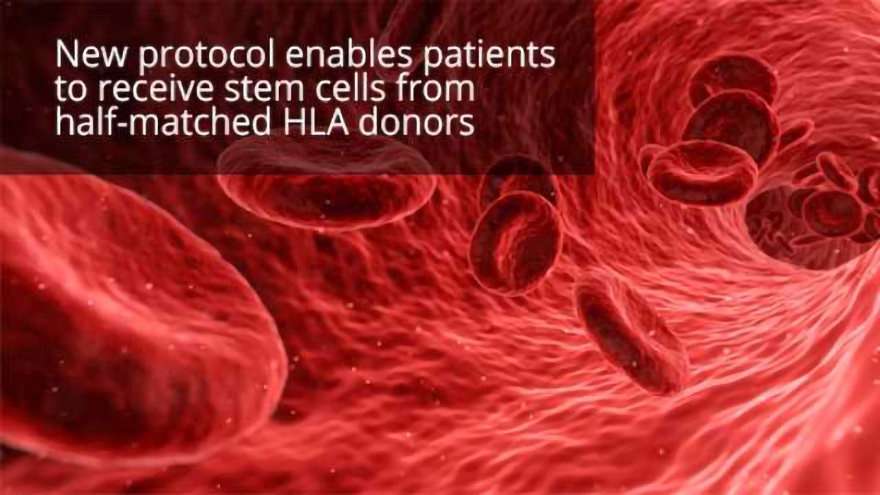 ‘Incompatible’ Donor Stem Cells Cure Adult Sickle Cell Patients