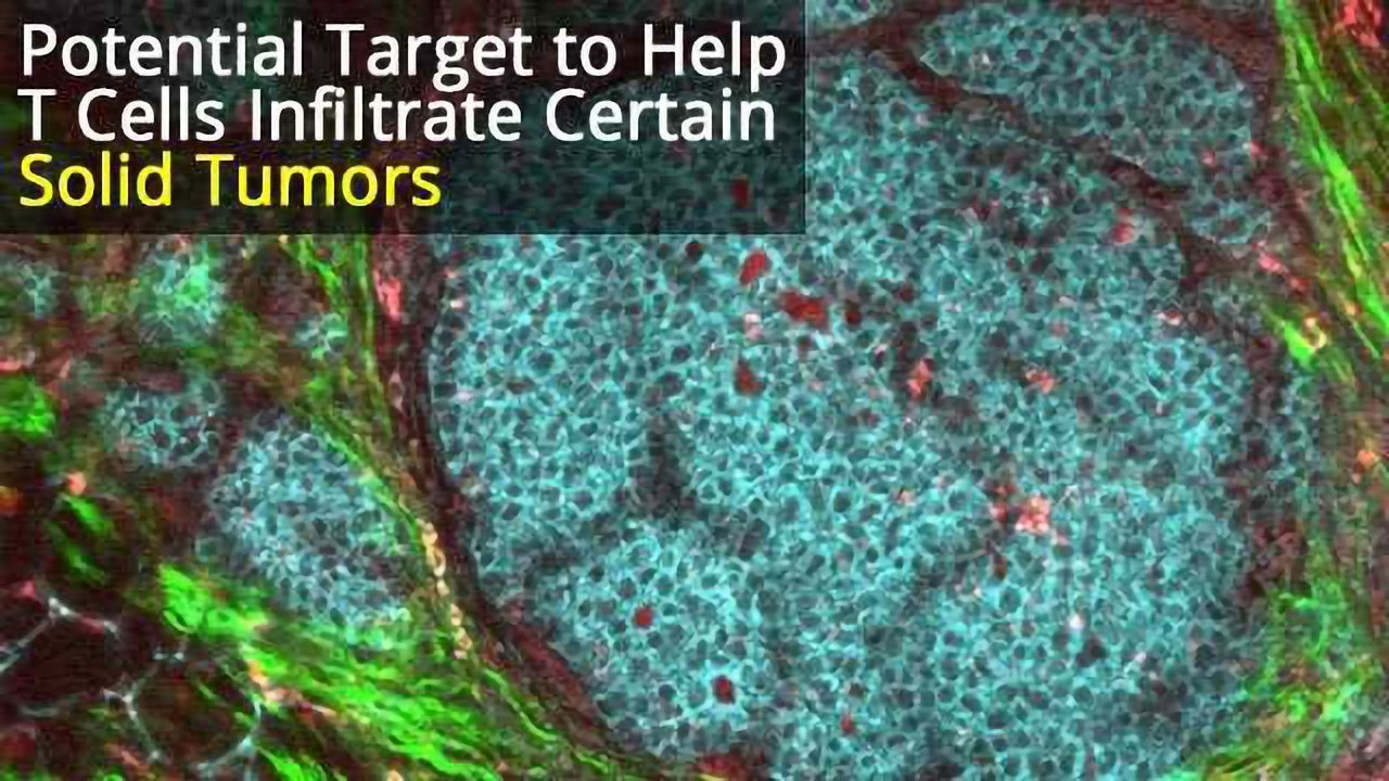 New Target for Immunotherapy for Solid Tumors?