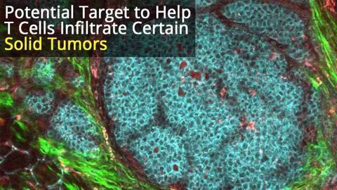 New Target for Immunotherapy for Solid Tumors?