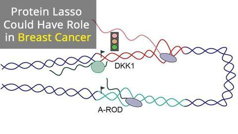 The Protein Lasso Implicated in Breast Cancer