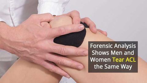 Forensic Analysis Sheds Light on Ligament Injuries