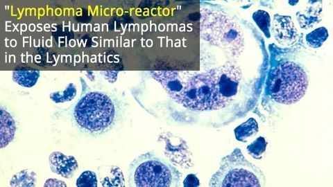 “Lymphoma Micro-reactor” Targets Chemo-Resistant Lymphoma
