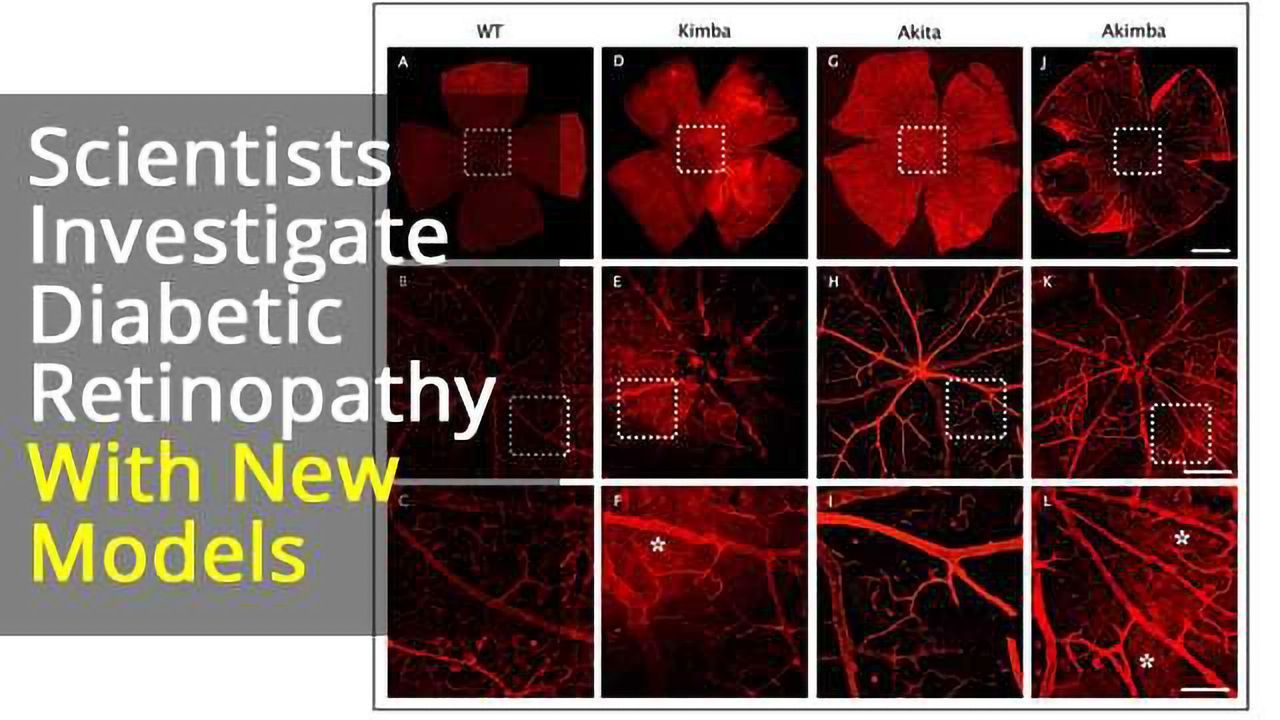 Investigating Inflammasomes Implicated in Diabetic Retinopathy