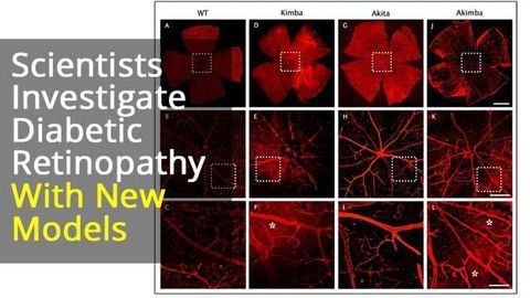 Investigating Inflammasomes Implicated in Diabetic Retinopathy