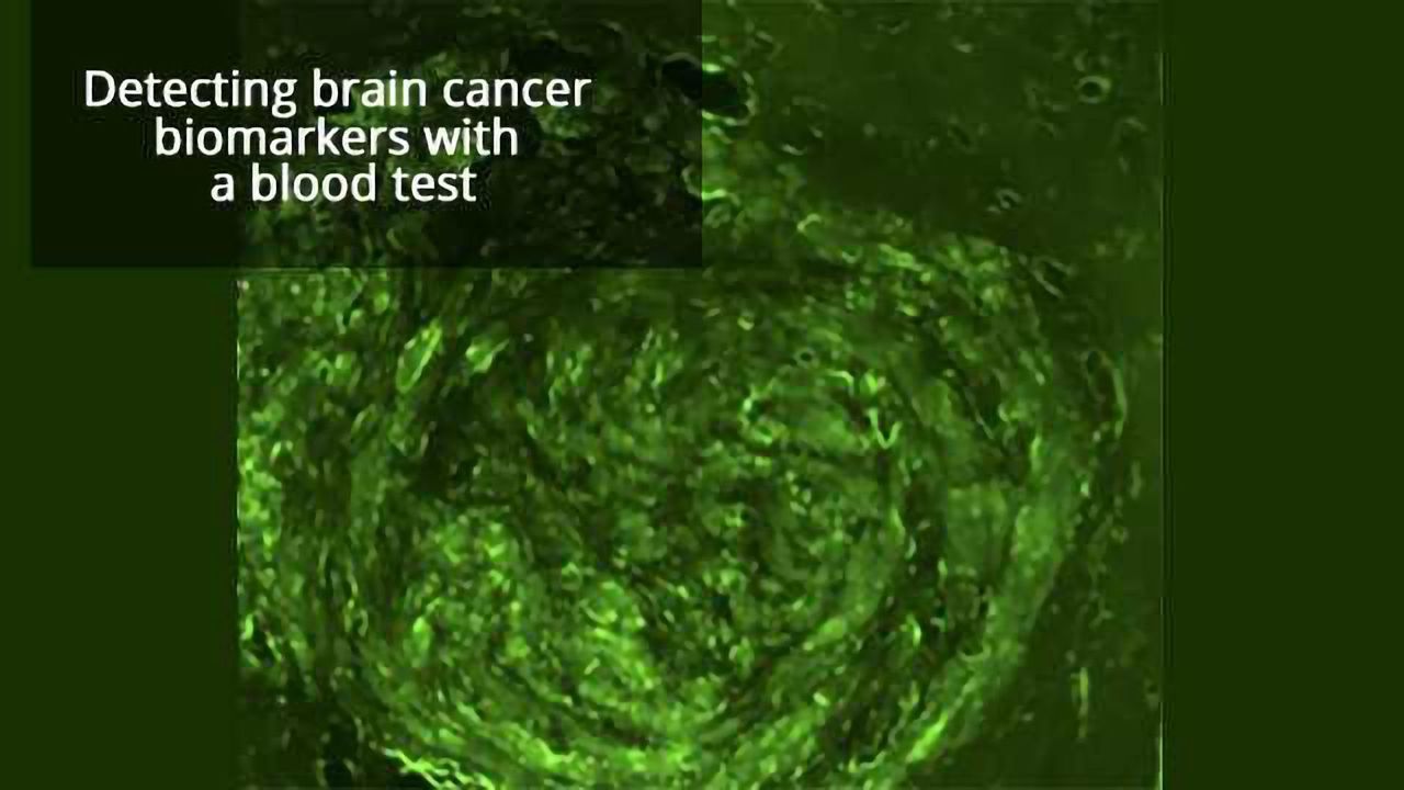 Noninvasive Brain Tumor Biopsy on the Horizon