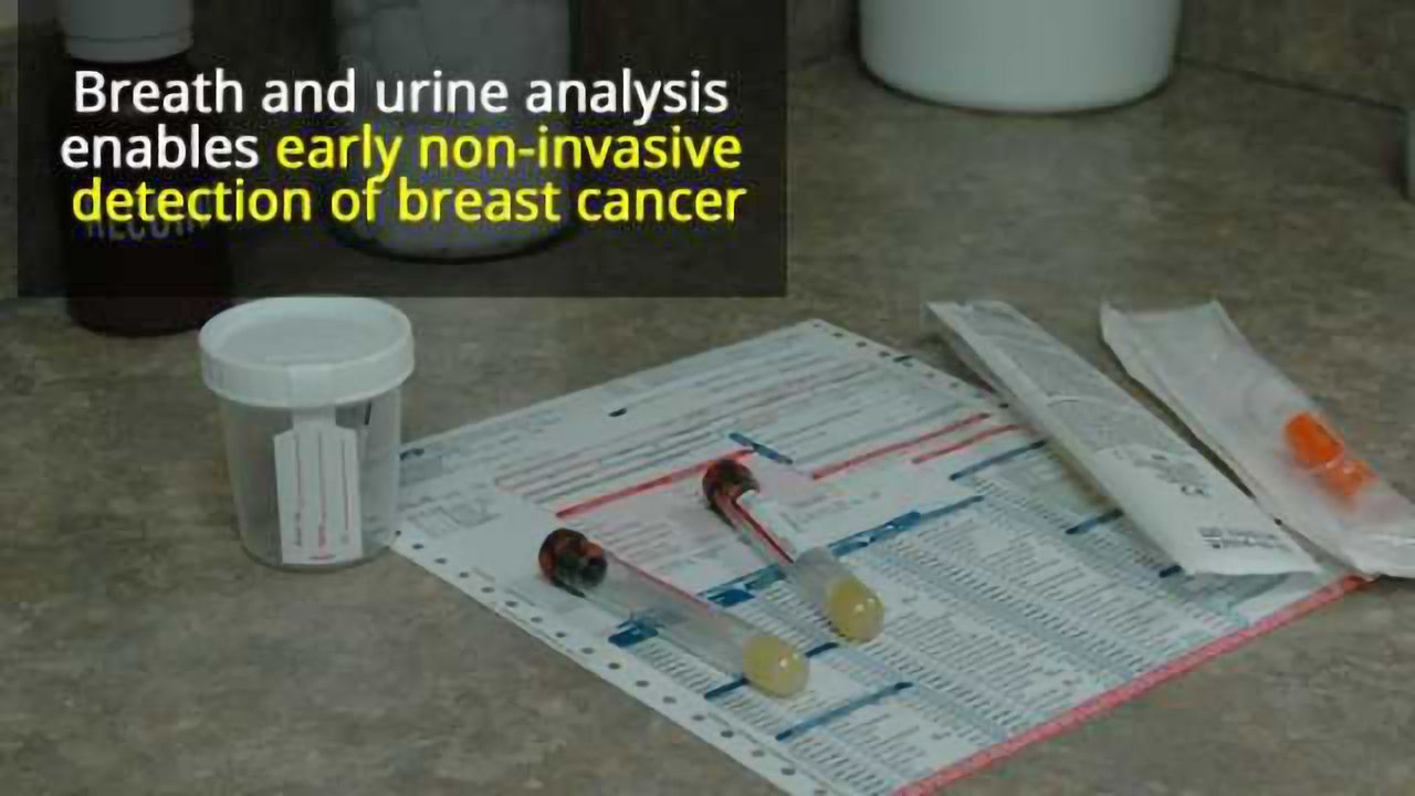 New Breath and Urine Tests Detect Early Breast Cancer More Accurately