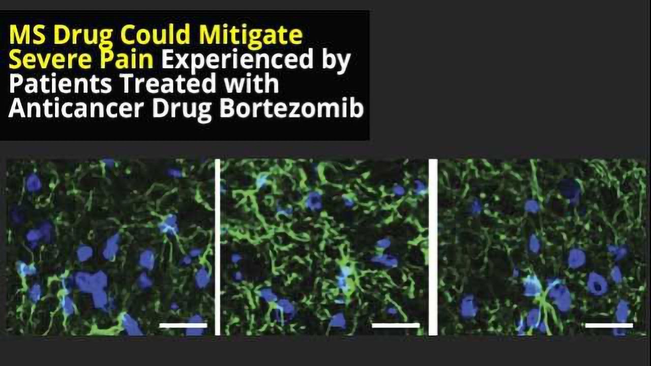 MS Drug Could Reduce Painful Adverse Effects of Cancer Treatment