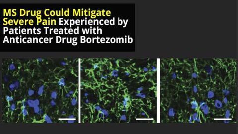 MS Drug Could Reduce Painful Adverse Effects of Cancer Treatment