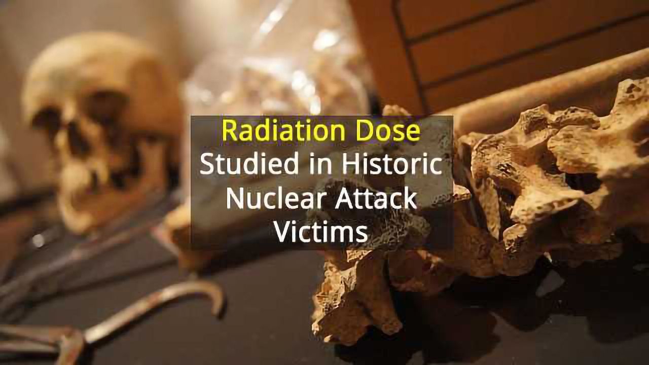 Radiation Dose Calculated in Bone from Victims of Hiroshima Bombing