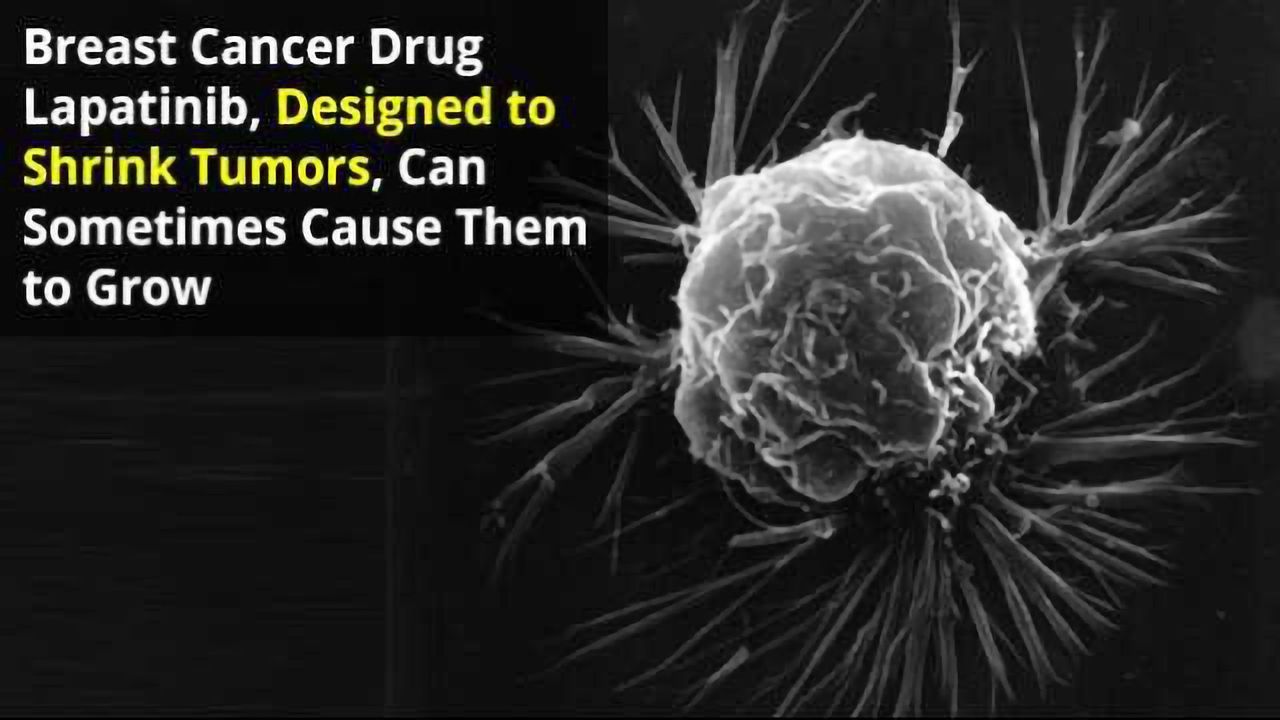 Breast Cancer Drug Shown to Accelerate Cancer Cell Growth