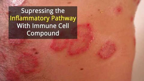 Immune Cell Compound Used To Treat Psoriasis