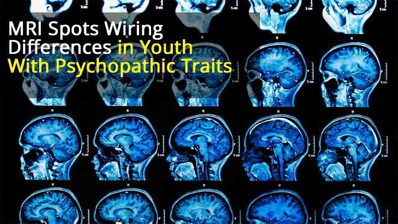 MRI Study Shows Brains of Young People With Severe Behavioural Problems ‘Wired Differently’