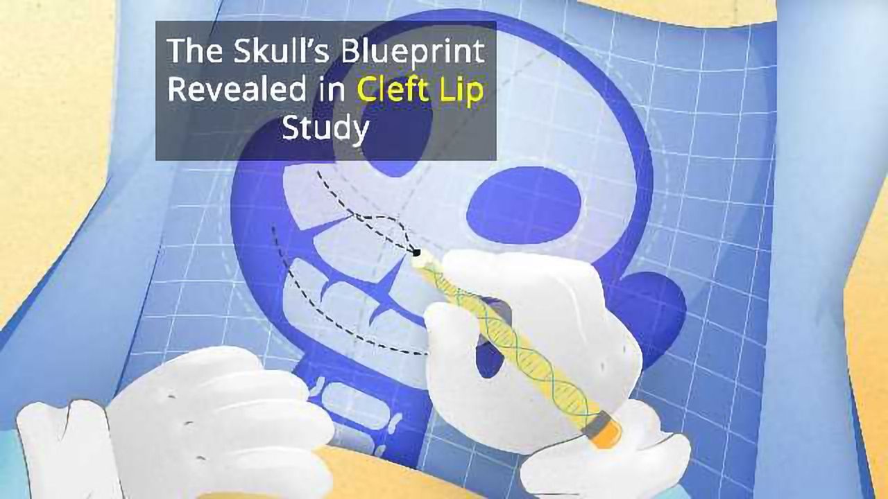 Facial Blueprint Study Suggests Epigenomic DNA is Responsible for Cleft Lip