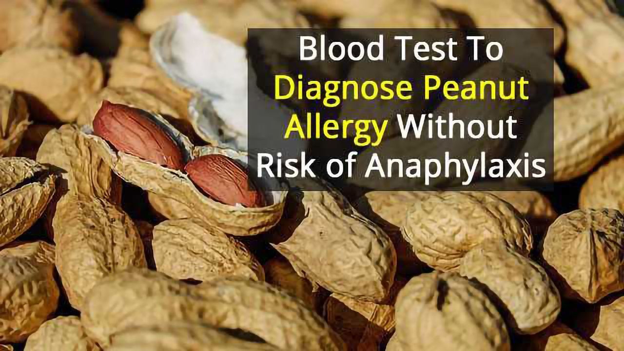 Test to Safely and Accurately Diagnose Peanut Allergies