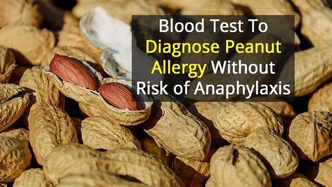 Test to Safely and Accurately Diagnose Peanut Allergies