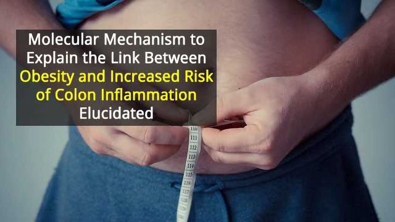 Identifying the Mechanism in Obesity’s Link to Colon Cancer