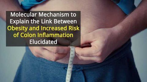 Identifying the Mechanism in Obesity’s Link to Colon Cancer