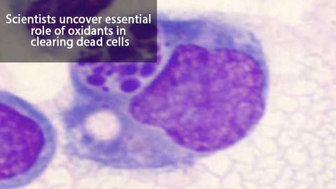 Proper Burial of Dead Cells Limits Inflammation