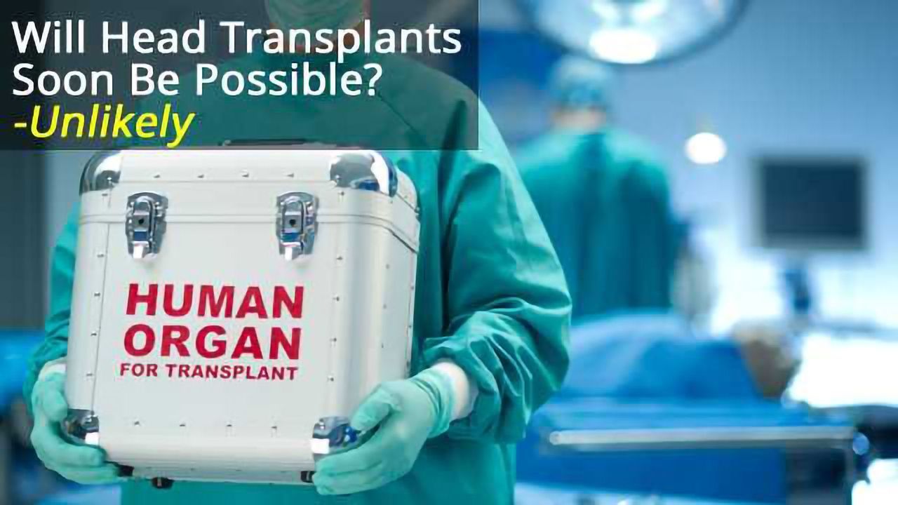 Take It From Me: Neuroscience is advancing, but we’re a long way off head transplants