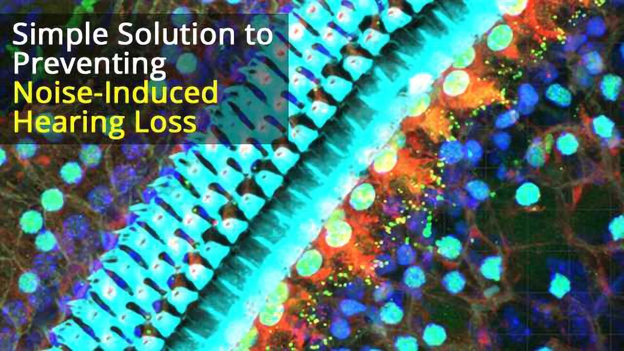 Noise-Induced Hearing Loss Prevented: Simple solution saves sound sensing cells