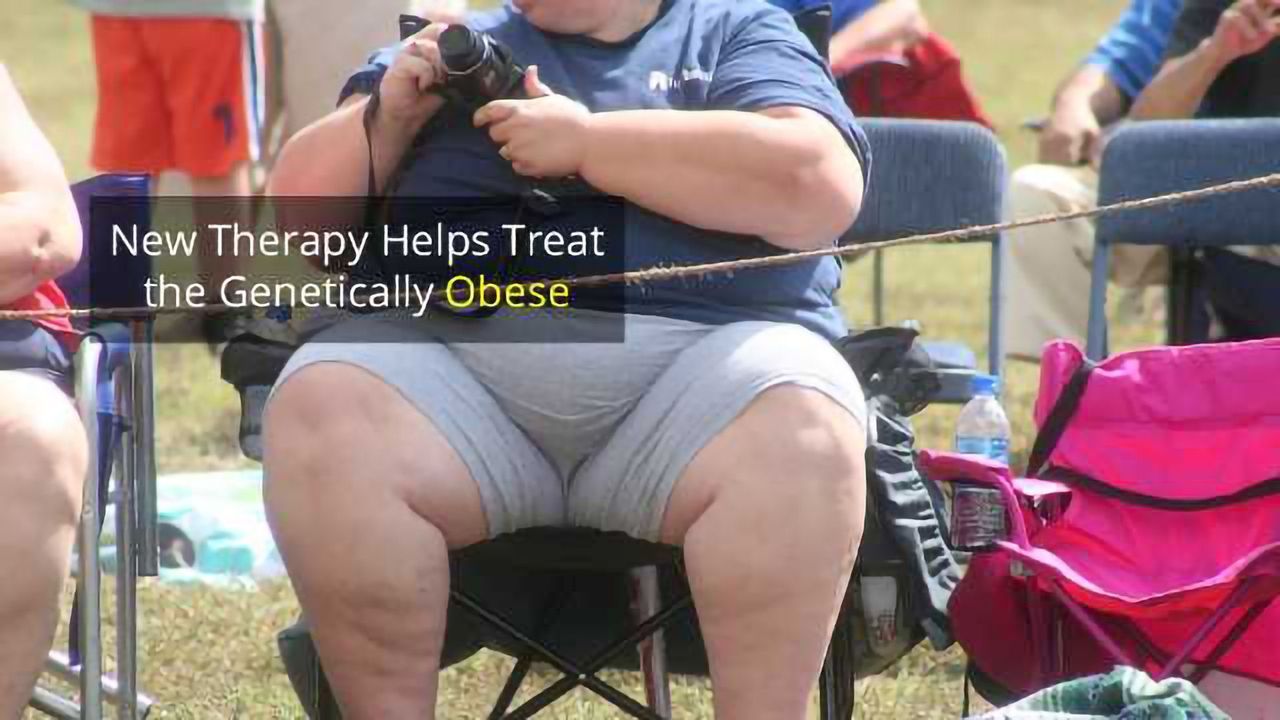 Peptide Therapy Ends Insatiable Hunger in Genetically Obese Patients