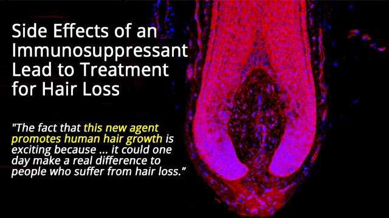 A Cure for Baldness on the Horizon?