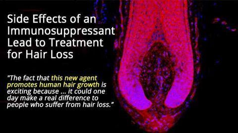 A Cure for Baldness on the Horizon?