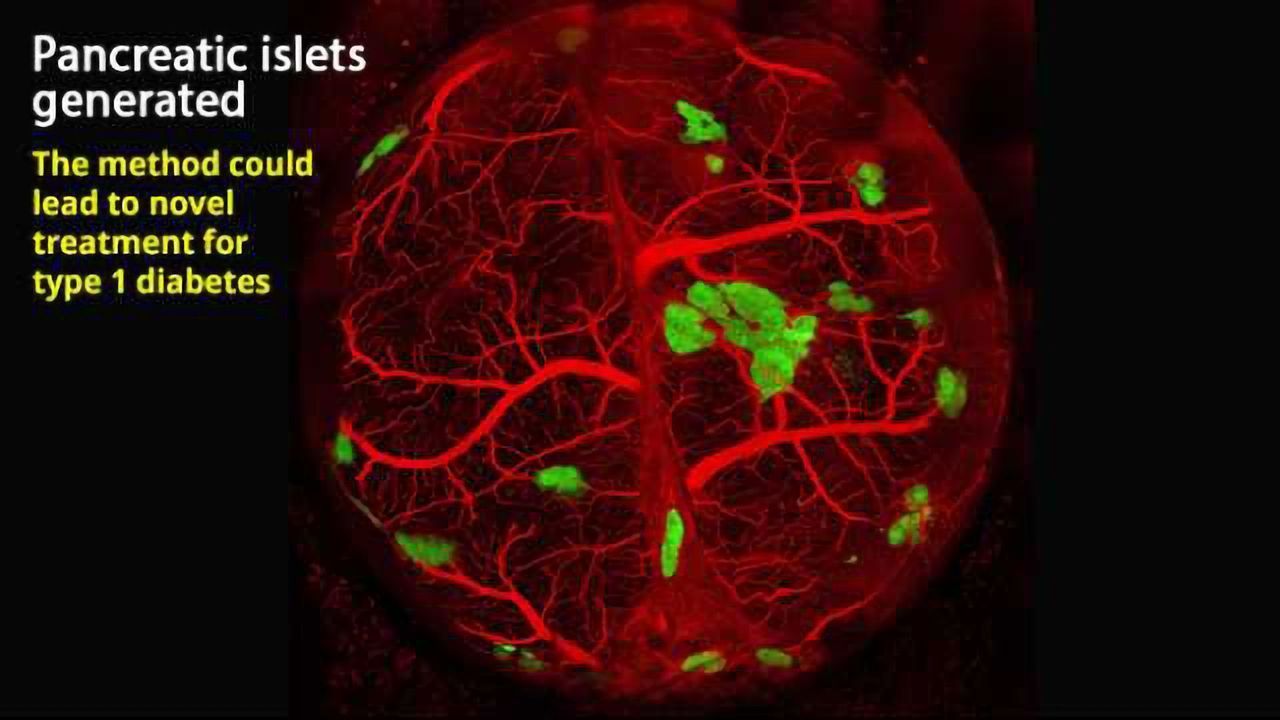 Tissue Engineered Human Pancreas Cells Successfully Treat Diabetic Mice