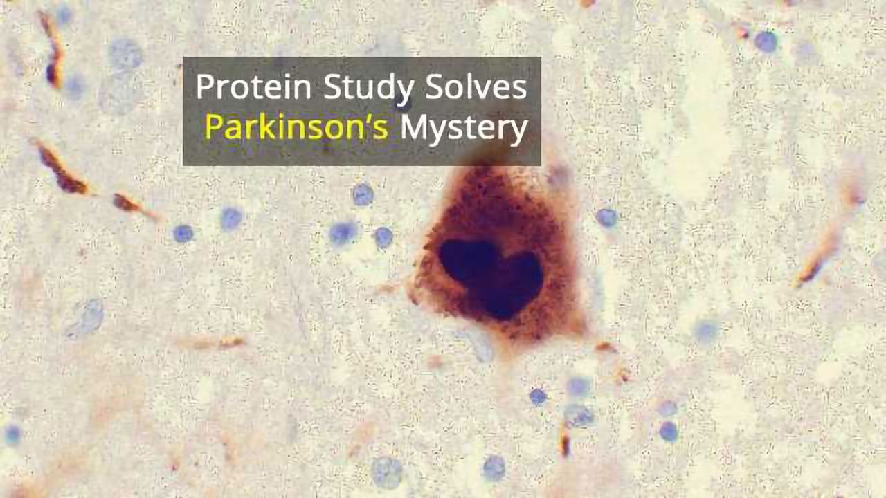 Parkinson's Protein Changes Shape Depending on Cell Type