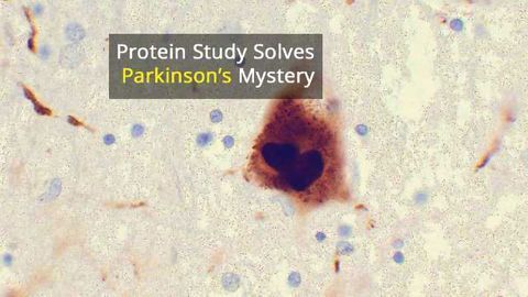 Parkinson's Protein Changes Shape Depending on Cell Type