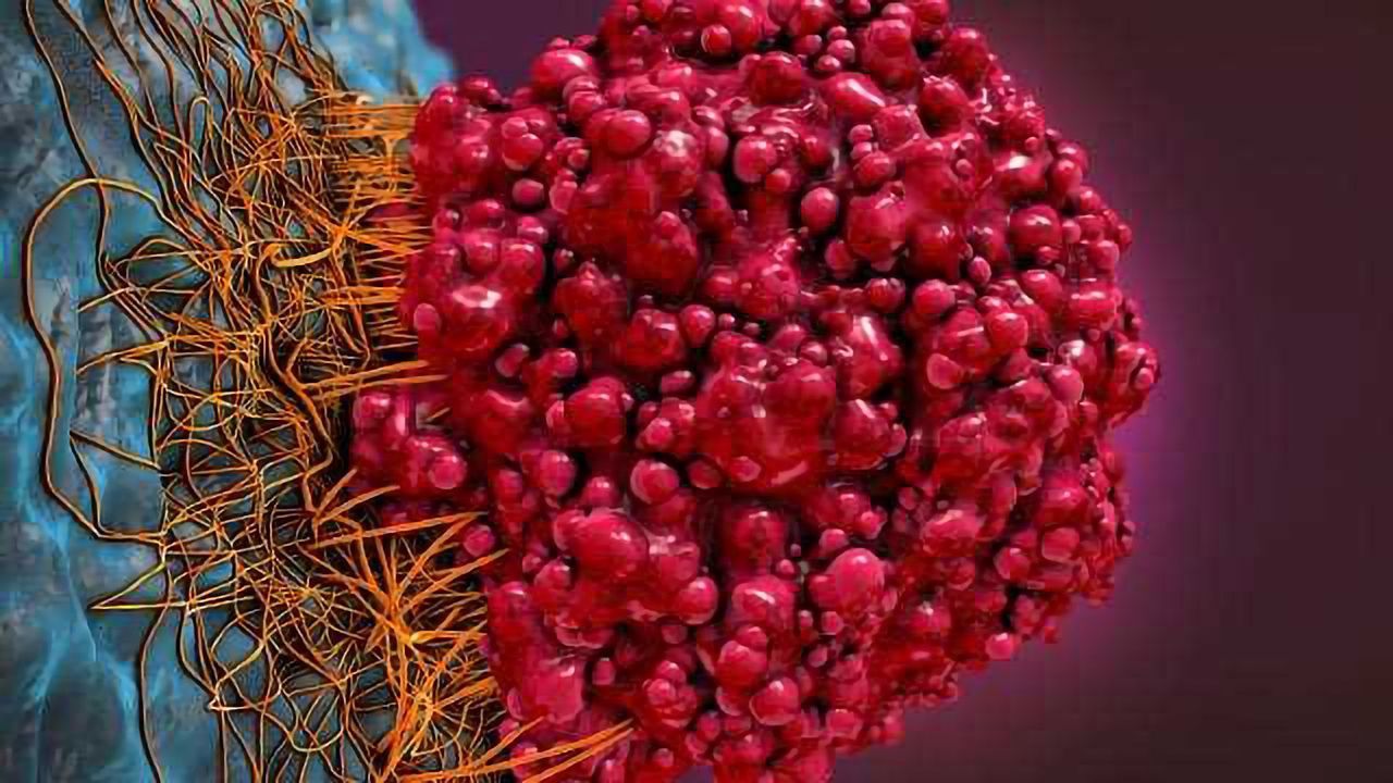 Exploiting the Tumor Microenvironment for Cancer Therapeutics
