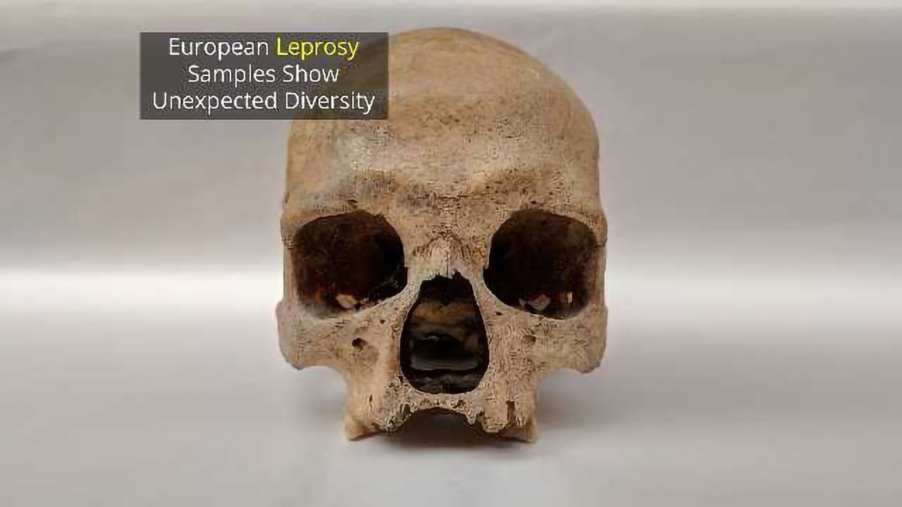 Ancient British Leprosy Genome Points Finger at Squirrels
