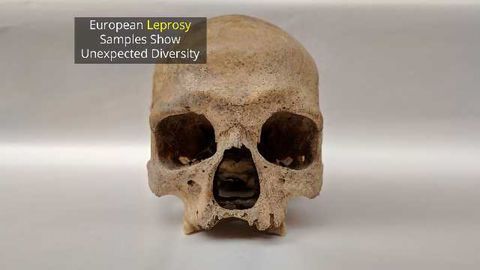 Ancient British Leprosy Genome Points Finger at Squirrels