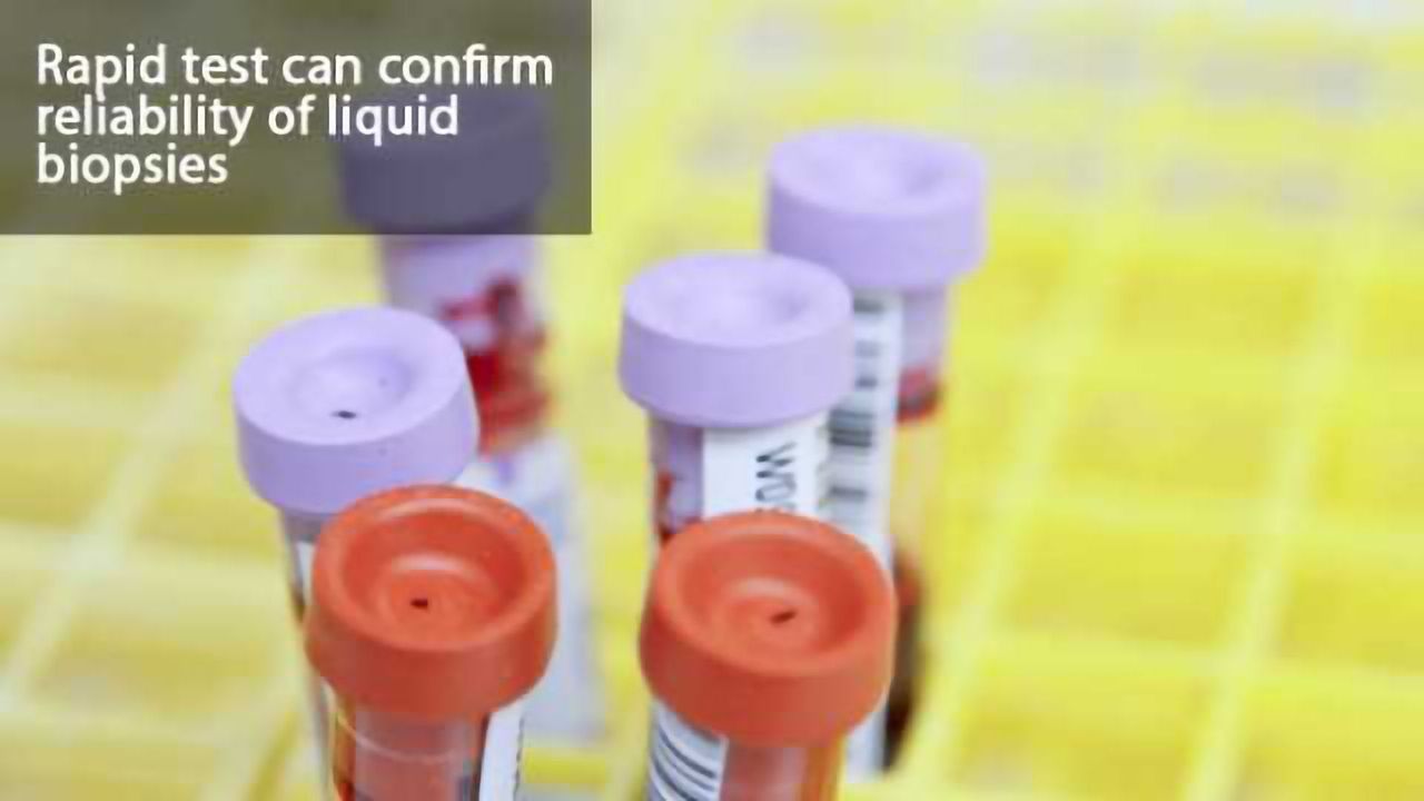 Quality-Control Test for Liquid Biopsies Developed
