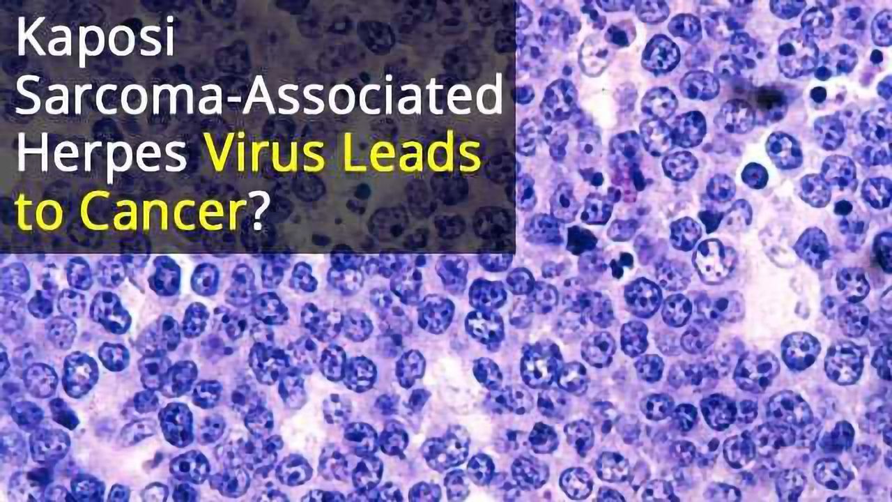 Viral Protein Helps Drive Cancer