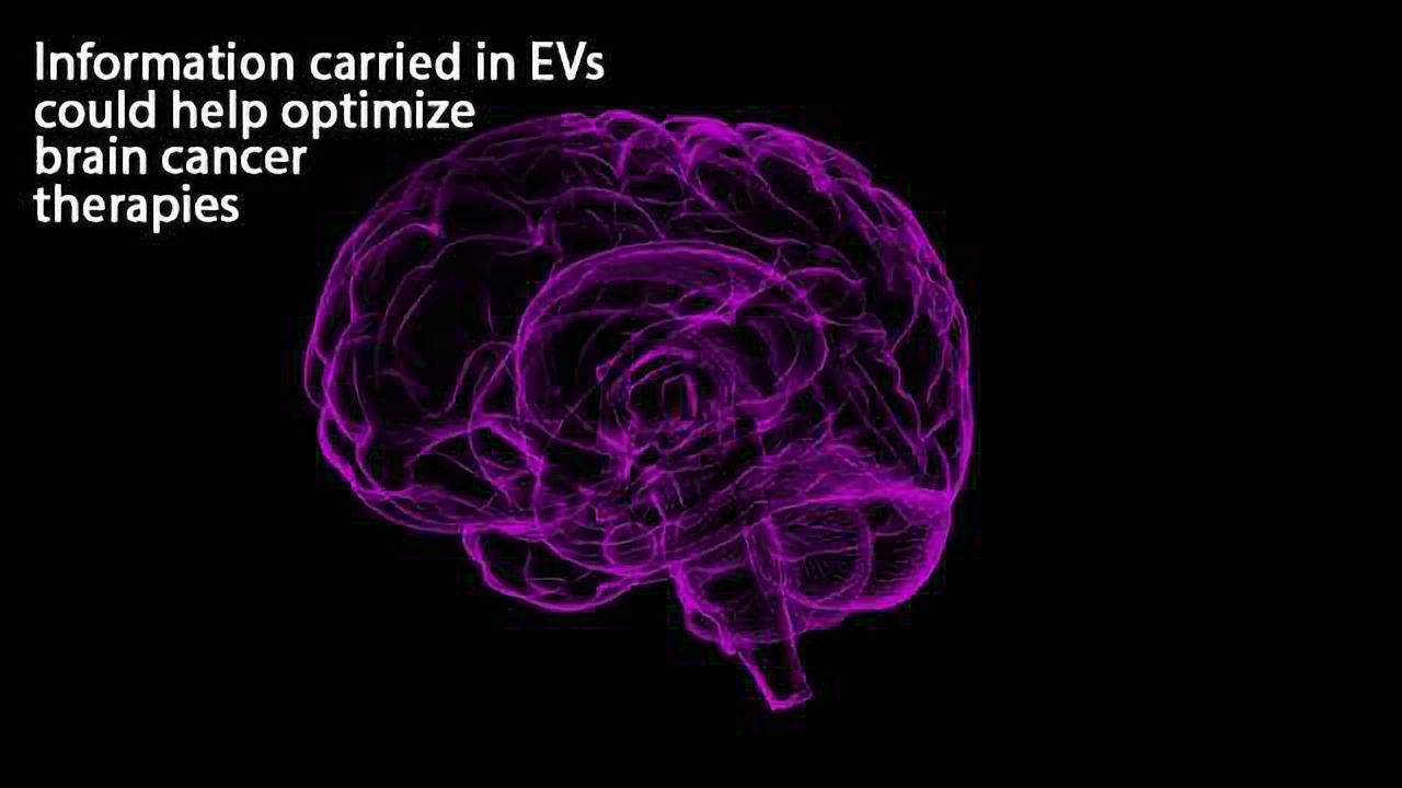 Microfluidic Device Captures Extracellular Vesicles Shed by Brain Tumors