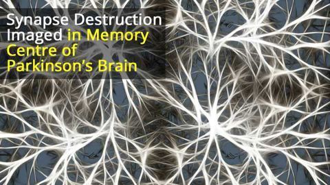 Paradoxical Changes in Hippocampal Neurons Underlies Parkinson's, Dementia